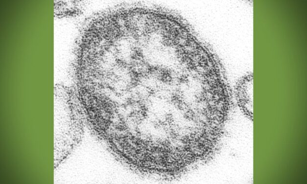 Infant with measles may have exposed others recently at Sea-Tac Airport, Children’s Hospital