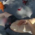 VIDEO: Teen wounded in North SeaTac Park shooting later said injury was self-inflicted